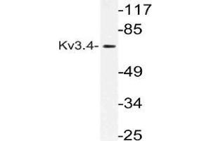 Western blot (WB) analysis of Kv3. (Kv3.4 anticorps)