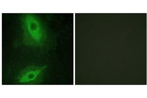 Immunofluorescence analysis of HeLa cells, using TNFSF15 antibody. (TNFSF15 anticorps  (C-Term))