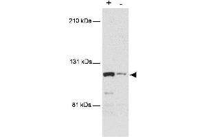 Western blot using  anti-MTBP antibody shows detection of a band ~110 kDa corresponding to human MTBP (arrowhead). (MTBP anticorps  (AA 667-812))