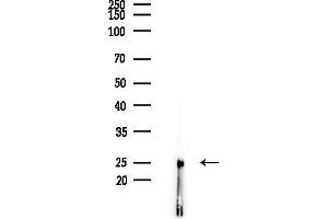 anti-NADH Dehydrogenase (Ubiquinone) Flavoprotein 2, 24kDa (NDUFV2) (N-Term) antibody