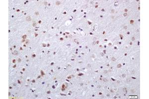 Formalin-fixed and paraffin embedded rat brain labeled with Anti-Phosphoserine/threonine Polyclonal Antibody, Unconjugated (ABIN1385068) at 1:200 followed by conjugation to the secondary antibody and DAB staining (Phosphoserine/Threonine (phosphorylated) anticorps)