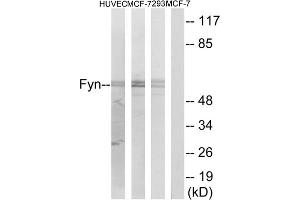 Western blot analysis of extracts from HUVEC cells, MCF-7 cells and 293 cells, using Fyn (epitope around residue 530) antibody. (FYN anticorps  (Tyr530))