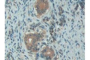 Detection of C1INH in Rat Uterus Tissue using Polyclonal Antibody to Complement 1 Inhibitor (C1INH)