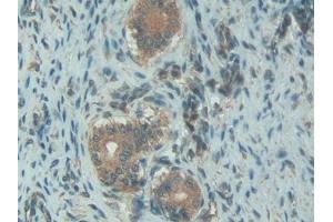 Detection of C1INH in Rat Uterus Tissue using Polyclonal Antibody to Complement 1 Inhibitor (C1INH) (SERPING1 anticorps  (AA 148-270))