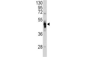 Western Blotting (WB) image for anti-Galactosidase, alpha (GLA) antibody (ABIN3002776) (GLA anticorps)