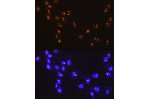 Immunofluorescence analysis of NIH-3T3 cells using Fibrillarin/U3 RNP Rabbit mAb (ABIN7267175) at dilution of 1:100 (40x lens).