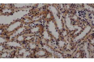 Immunohistochemistry of paraffin-embedded Rat kidney using GLUT-1 Polyclonal Antibody at dilution of 1:50 (GLUT1 anticorps)