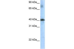 Western Blotting (WB) image for anti-TSC22 Domain Family, Member 4 (TSC22D4) antibody (ABIN2461507)
