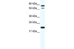 Western Blot showing ZFP287 antibody used at a concentration of 1-2 ug/ml to detect its target protein. (ZNF287 anticorps  (N-Term))