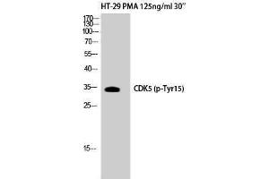 Western Blotting (WB) image for anti-Cyclin-Dependent Kinase 5 (CDK5) (pTyr15) antibody (ABIN3179551) (CDK5 anticorps  (pTyr15))