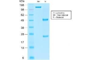 SDS-PAGE Analysis Purified EpCAM Mouse Recombinant Monoclonal Antibody (rEGP40/1110).