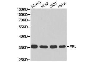 Western blot analysis of extracts of various cell lines, using PRL antibody. (Prolactin anticorps  (AA 29-227))