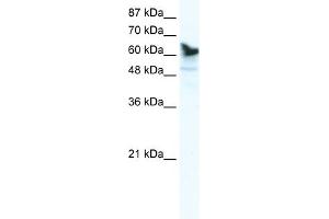 WB Suggested Anti-DDX41 Antibody Titration:  1. (DDX41 anticorps  (C-Term))