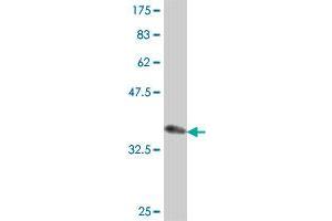 Western Blot detection against Immunogen (38.