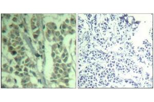anti-Cas-Br-M (Murine) Ecotropic Retroviral Transforming Sequence (CBL) (pTyr770) antibody