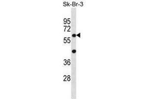 STXBP3 Antibody (Center) western blot analysis in SK-BR-3 cell line lysates (35µg/lane). (STXBP3 anticorps  (Middle Region))