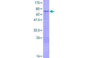 Image no. 1 for Uridine Monophosphate Synthetase (UMPS) (AA 1-480) protein (GST tag) (ABIN1324637)