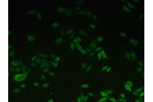 Detection of CYP1A2 in Hela cells using Polyclonal Antibody to Cytochrome P450 1A2 (CYP1A2)
