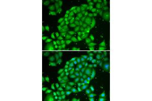 Immunofluorescence analysis of U2OS cells using TCL1A antibody (ABIN5970229). (TCL1A anticorps)