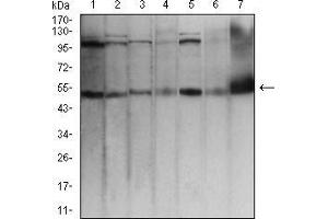 Western blot analysis using TFAP2A mouse mAb against Hela (1), MCF-7 (2), Cos7 (3), A431 (4), HCT116 (5), NIH/3T3 (6), and PC12 (7) cell lysate. (TFAP2A anticorps  (AA 1-100))