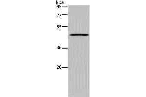 Western Blot analysis of Mouse lung tissue using MECP2 Polyclonal Antibody at dilution of 1:300 (MECP2 anticorps)
