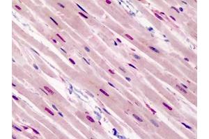 Human Heart: Formalin-Fixed, Paraffin-Embedded (FFPE) (GATA3 anticorps  (N-Term))