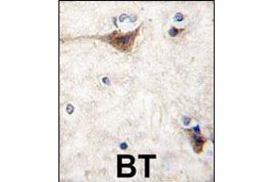 Formalin-fixed and paraffin-embedded human brain tissue reacted with CDH10 antibody (N-term), which was peroxidase-conjugated to the secondary antibody, followed by DAB staining.