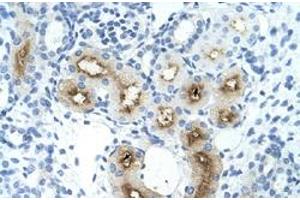 Immunohistochemical staining (Formalin-fixed paraffin-embedded sections) of human kidney with GGTLC1 polyclonal antibody  at 4-8 ug/mL working concentration. (GGTLC1 anticorps  (C-Term))