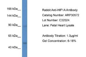 WB Suggested Anti-HIF1A Antibody   Titration: 1.
