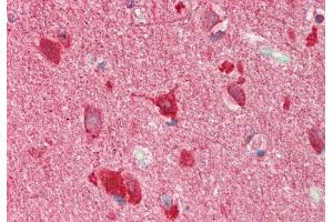 Rabbit Anti-TSC22D2 antibody  Formalin Fixed Paraffin Embedded Tissue: Human Brain, Cortex Primary antibody Concentration: 1:100 Secondary Antibody: Donkey anti-Rabbit-Cy3 Secondary Antibody Concentration: 1:200 Magnification: 20x Exposure Time: 0. (TSC22D2 anticorps  (N-Term))