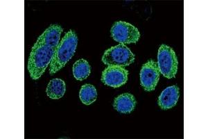 Confocal immunofluorescent analysis of alpha Actin antibody with A549 cells followed by Alexa Fluor 488-conjugated goat anti-rabbit lgG (green).