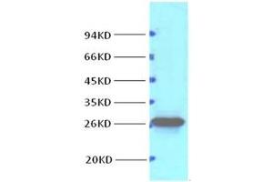 Western Blot (WB) analysis of HeLa, diluted at 1:1000.