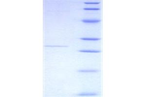 SDS-PAGE (SDS) image for C-Reactive Protein (CRP) (AA 17-224) protein (His tag) (ABIN1169959)