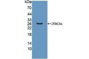 Detection of Recombinant TNFSF9, Human using Polyclonal Antibody to Tumor Necrosis Factor Ligand Superfamily, Member 9 (TNFSF9)