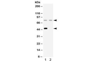 Western blot testing of 1) rat liver and 2) human HeLa lysate with Factor I antibody. (Complement Factor I anticorps)