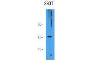 The 293T cell lysate (40 ug) were resolved by SDS-PAGE, transferred to PVDF membrane and probed with anti-human AKR7A3 antibody (1:1000). (AKR7A3 anticorps)