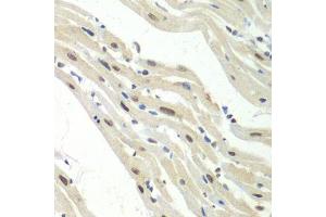 Immunohistochemistry of paraffin-embedded mouse heart using UPF1 antibody.