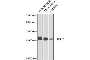 Western blot analysis of extracts of various cell lines, using BNIP1 Antibody (ABIN6127501, ABIN6137615, ABIN6137617 and ABIN6223088) at 1:1000 dilution. (BNIP1 anticorps  (AA 1-200))