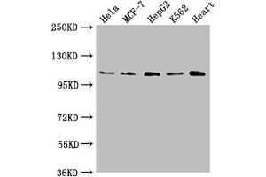 Western Blot Positive WB detected in: Hela whole cell lysate, MCF-7 whole cell lysate, HepG2 whole cell lysate, K562 whole cell lysate, Mouse heart tissue All lanes: OPA1 antibody at 1:2000 Secondary Goat polyclonal to rabbit IgG at 1/50000 dilution Predicted band size: 112, 116 kDa Observed band size: 112 kDa