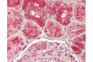 Human Kidney: Formalin-Fixed, Paraffin-Embedded (FFPE)