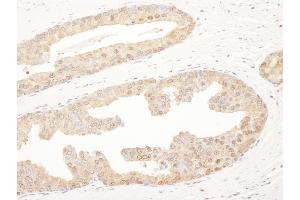 Immunohistochemistry (IHC) image for anti-Proteasome Subunit alpha 6 (PSMA6) (AA 196-246) antibody (ABIN7453443) (PSMA6 anticorps  (AA 196-246))