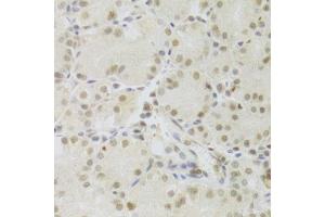 Immunohistochemistry of paraffin-embedded human stomach using PRPF3 Antibody. (PRPF3 anticorps  (AA 1-280))