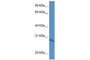 Western Blot showing 2610034B18Rik antibody used at a concentration of 1. (ARPIN anticorps  (N-Term))