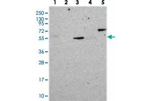 Western blot analysis of Lane 1: RT-4, Lane 2: U-251 MG, Lane 3: Human Plasma, Lane 4: Liver, Lane 5: Tonsil with CORO2A polyclonal antibody . (CORO2A anticorps)