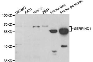 Western blot analysis of extracts of various cell lines, using SERPIND1 antibody (ABIN5973459) at 1/1000 dilution. (SERPIND1 anticorps)