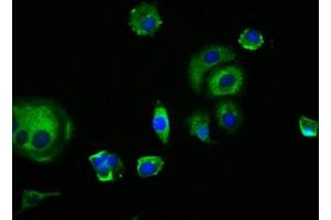 Immunofluorescence staining of MCF-7 cells with ABIN7173899 at 1:166, counter-stained with DAPI. (EDAR anticorps  (AA 27-170))