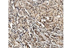 IHC analysis of HIF-1 alpha/HIF1A using anti-HIF-1 alpha/HIF1A antibody (ABIN7602159).