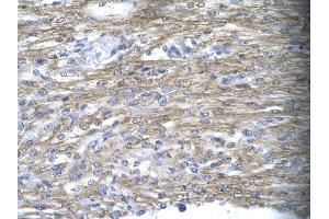 Rabbit Anti-MEOX1 Antibody       Paraffin Embedded Tissue:  Human cardiac cell   Cellular Data:  Epithelial cells of renal tubule  Antibody Concentration:   4. (MEOX1 anticorps  (N-Term))