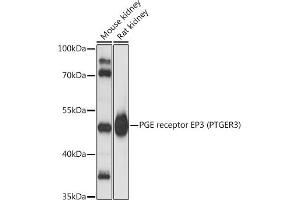 Western blot analysis of extracts of various cell lines, using PGE receptor EP3 (PTGER3) antibody (ABIN1682372, ABIN3018477, ABIN3018478 and ABIN6220477) at 1:3000 dilution. (PTGER3 anticorps  (AA 1-53))