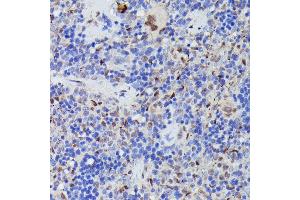 Immunohistochemistry of paraffin-embedded rat spleen using CDC23 antibody (ABIN7266248) at dilution of 1:100 (40x lens).